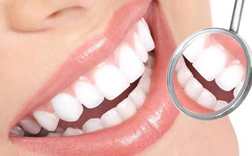 正畸出装有哪些注意事项？如何确保正畸效果最佳？